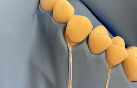 cerec