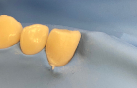 cerec